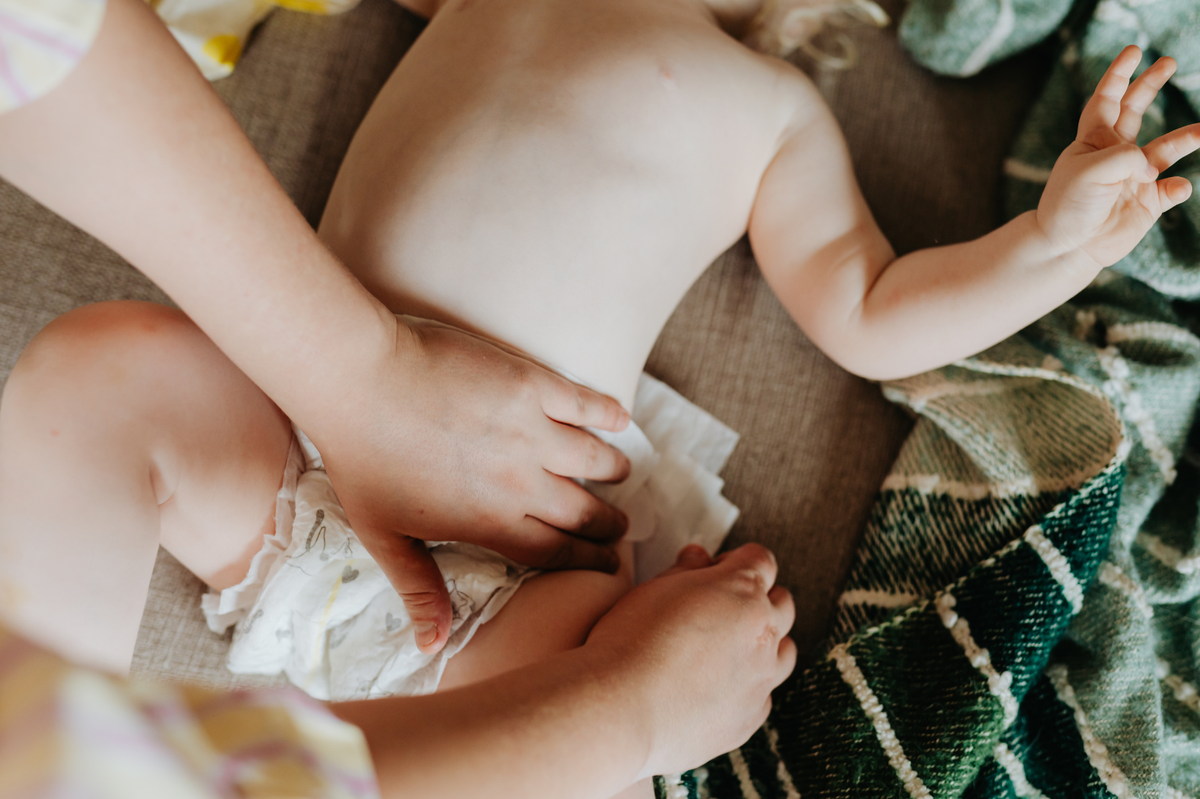 Can Diaper Rash Be Caused by Teething?