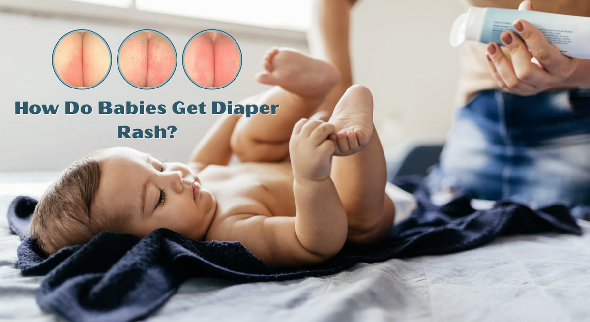 How Do Babies Get Diaper Rash And How To Prevent It